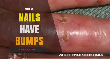 Understanding Nail Bumps: Causes, Concerns, and When to Seek Help