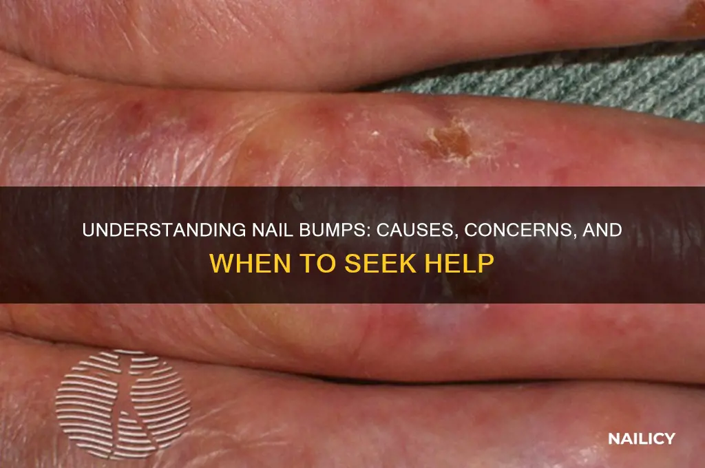 why do nails have bumps