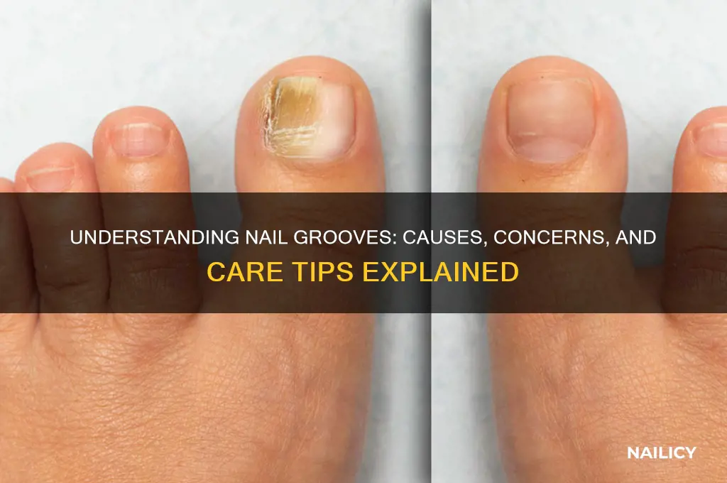 why do nails have grooves