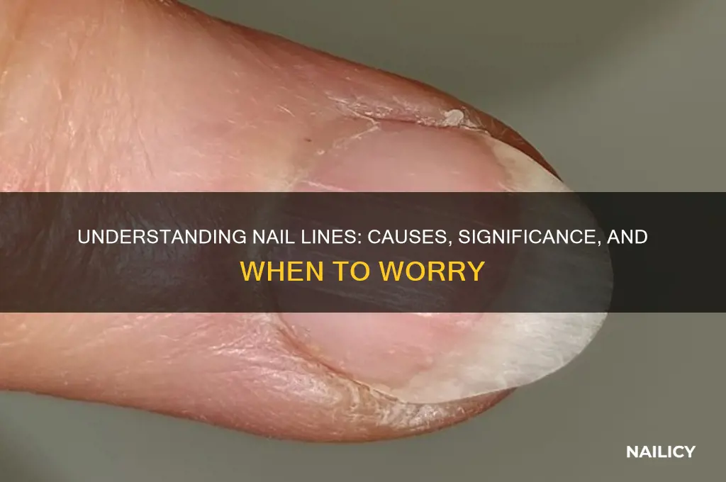 why do nails have lines