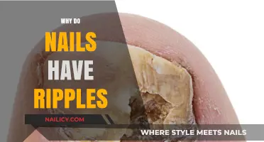 Why Do Nails Have Ripples? Uncovering the Surprising Causes