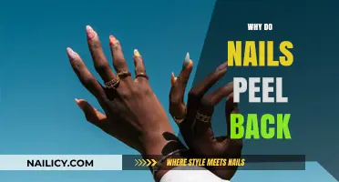Why Do Nails Peel Back? Causes and Solutions Explained
