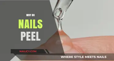 Why Do Nails Peel? Causes, Prevention, and Effective Solutions