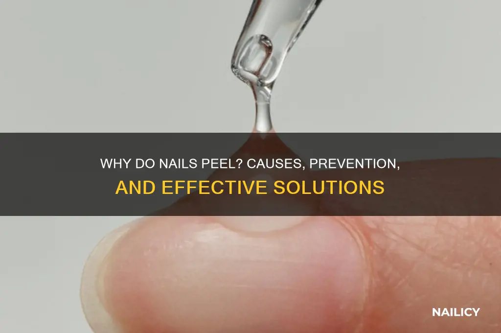 why do nails peel