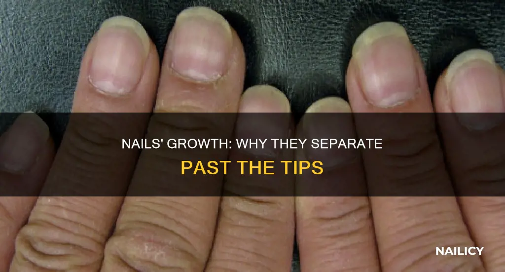 why do nails separate when they grow past finger tips