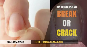 Why Nails Split, Break, or Crack: Causes and Prevention Tips