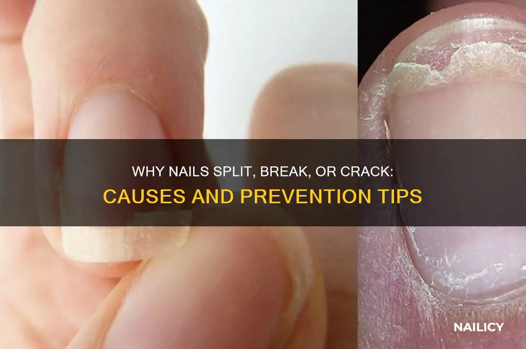 why do nails split and break or crack