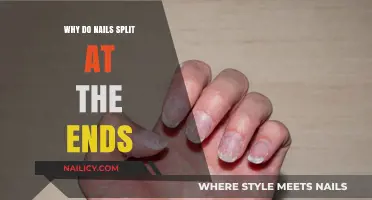 Why Do Nails Split at the Ends? Causes and Solutions