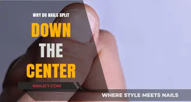 Why Do Nails Split Down the Center? Causes and Solutions