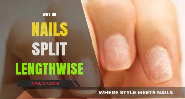 Why Do Nails Split Lengthwise? Causes and Effective Prevention Tips
