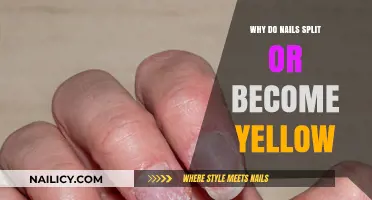 Why Nails Split or Turn Yellow: Causes and Solutions