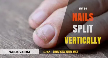 Why Do Nails Split Vertically? Causes and Effective Prevention Tips