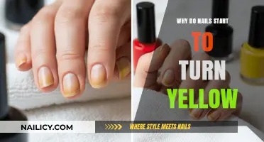 Why Do Nails Turn Yellow? Causes and Solutions Explained