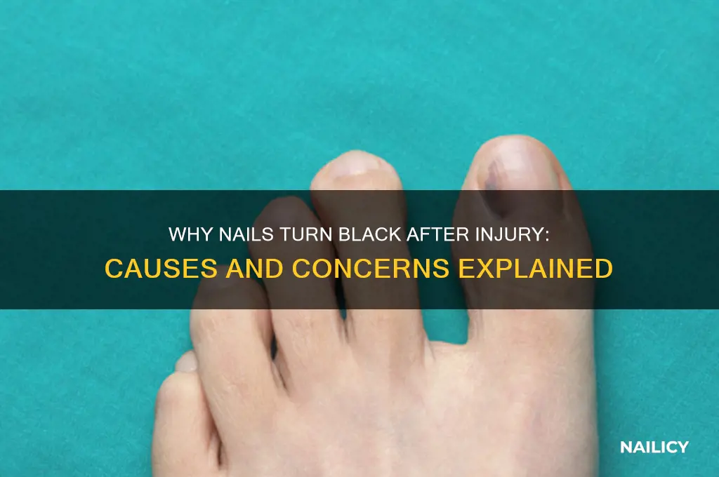 why do nails turn black after injury