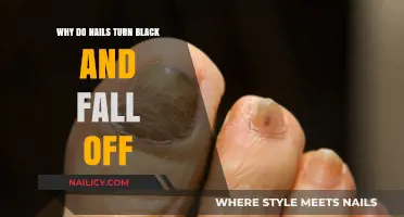 Black Nails and Loss: Causes, Risks, and Prevention Explained