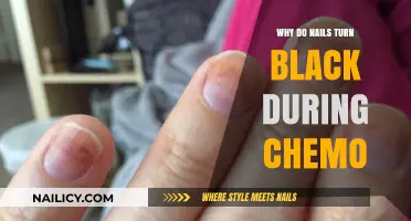 Understanding Black Nails During Chemotherapy: Causes and Coping Strategies