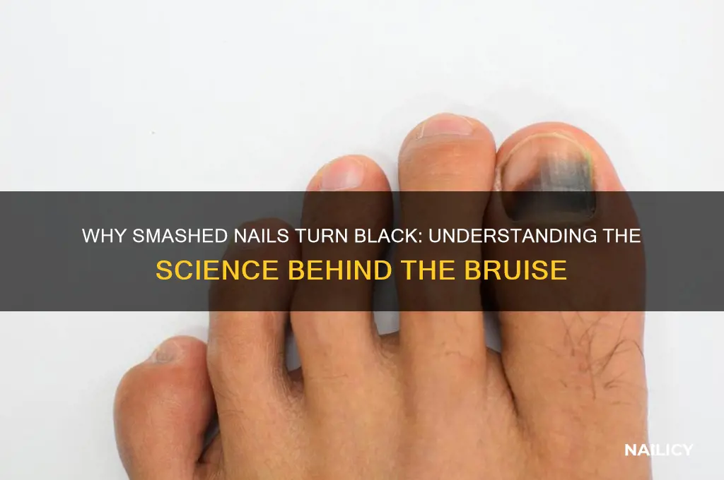 why do nails turn black when smashed