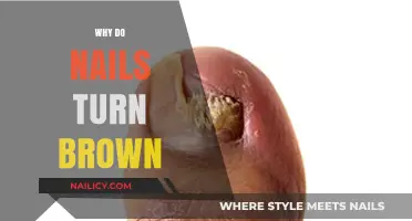 Why Do Nails Turn Brown? Causes, Prevention, and Treatment Options