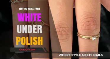 Why Nails Turn White Under Polish: Causes and Solutions