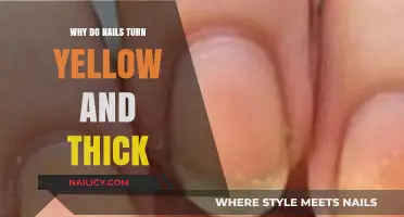 Why Nails Turn Yellow and Thick: Causes and Solutions