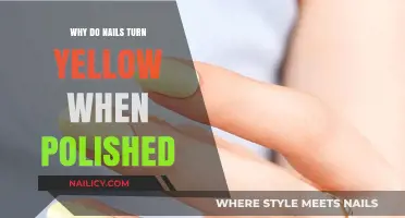 Why Do Nails Turn Yellow After Polishing? Causes and Solutions