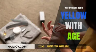Aging Nails: Understanding Why They Turn Yellow Over Time