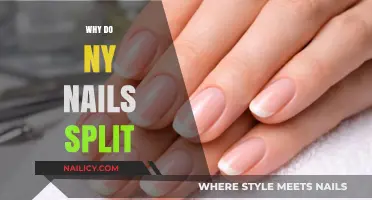 Why Do My Nails Split? Causes and Solutions for Brittle Nails