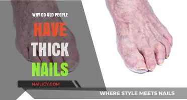 Why Do Old People Have Thick Nails? Aging and Nail Changes Explained