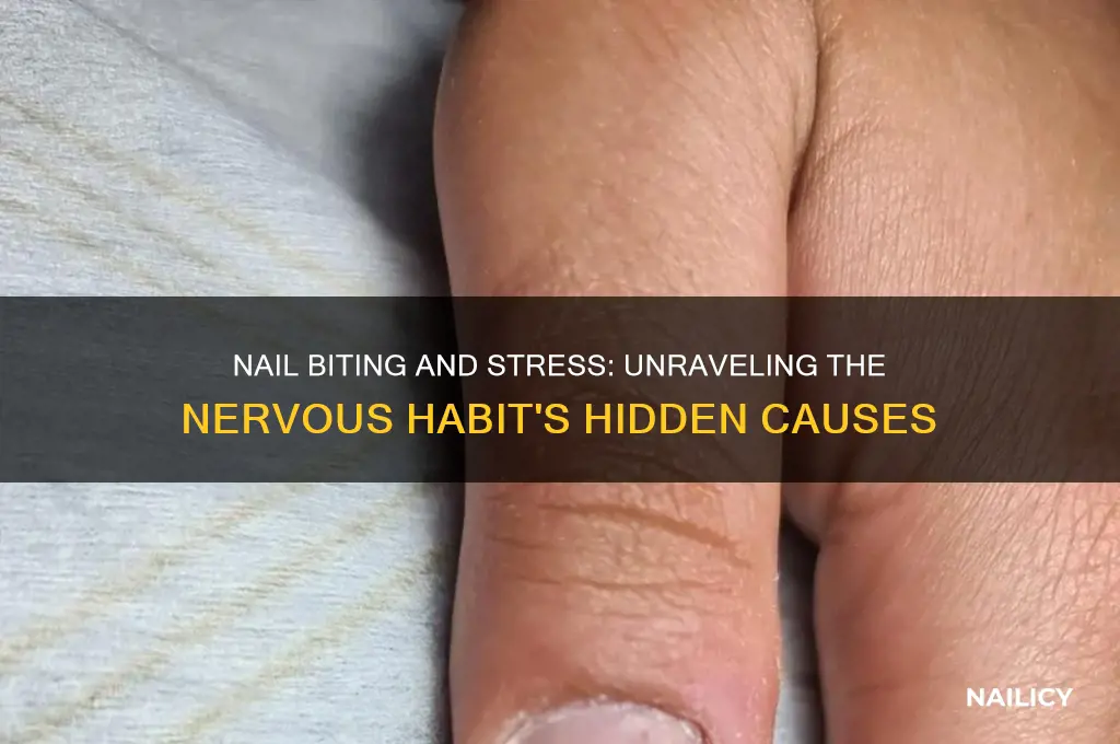 why do people bite their nails when stressed