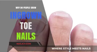 The Mystery of Ingrown Toe Nails: Why They Happen