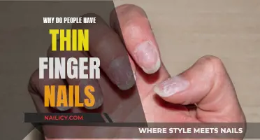 Unraveling the Mystery: Why Do Some People Have Thin Fingernails?