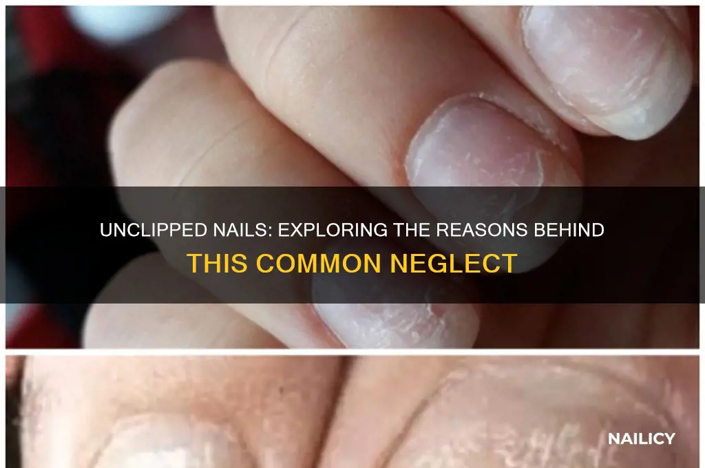 why do people not clip their nails