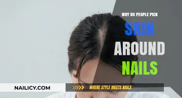 Understanding the Habit: Why People Pick Skin Around Nails
