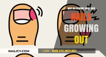 Strange Side Nails: Why Do They Grow That Way?