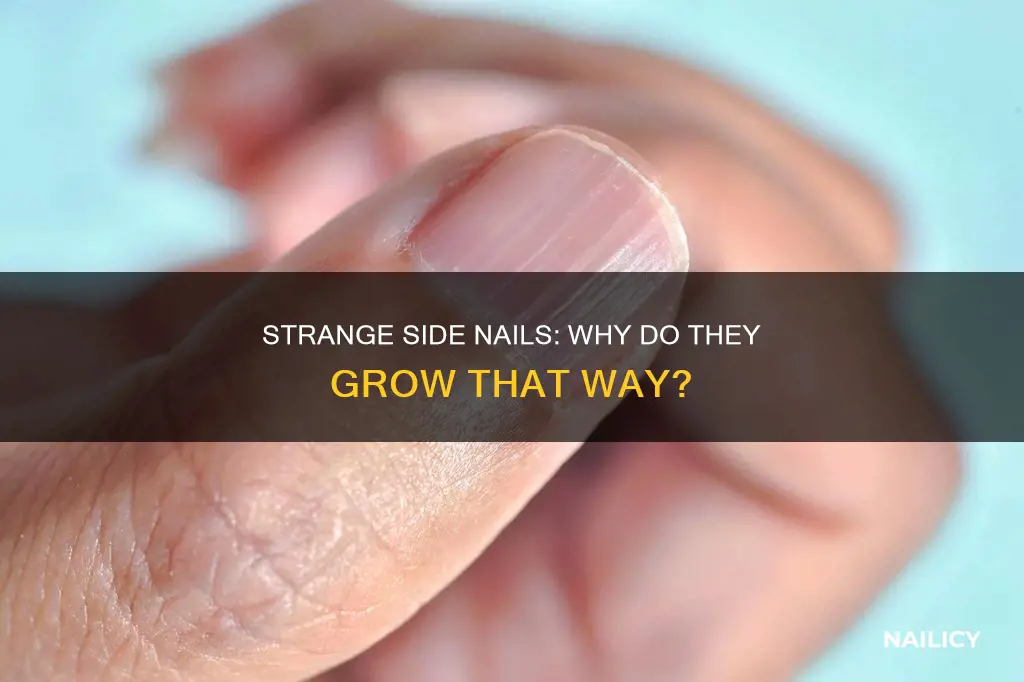 why do peopme have side nails growing out