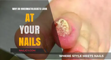 Why Rheumatologists Examine Your Nails: Uncovering Hidden Clues to Joint Health