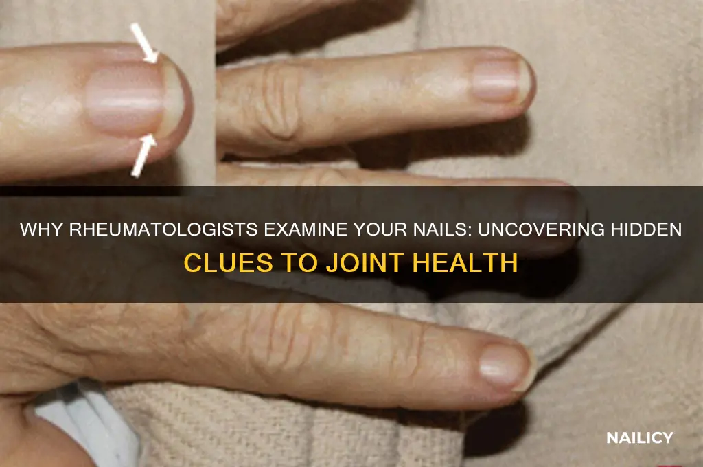 why do rheumatologists look at your nails