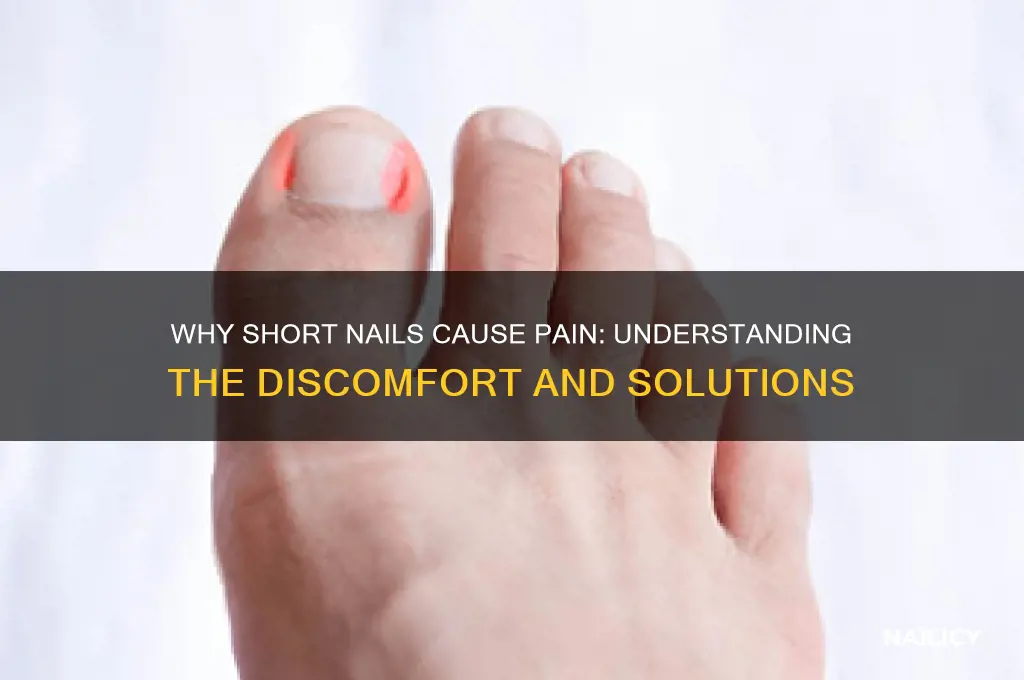 why do short nails hurt