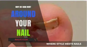 Why Does the Skin Around Your Nails Hurt? Causes and Remedies
