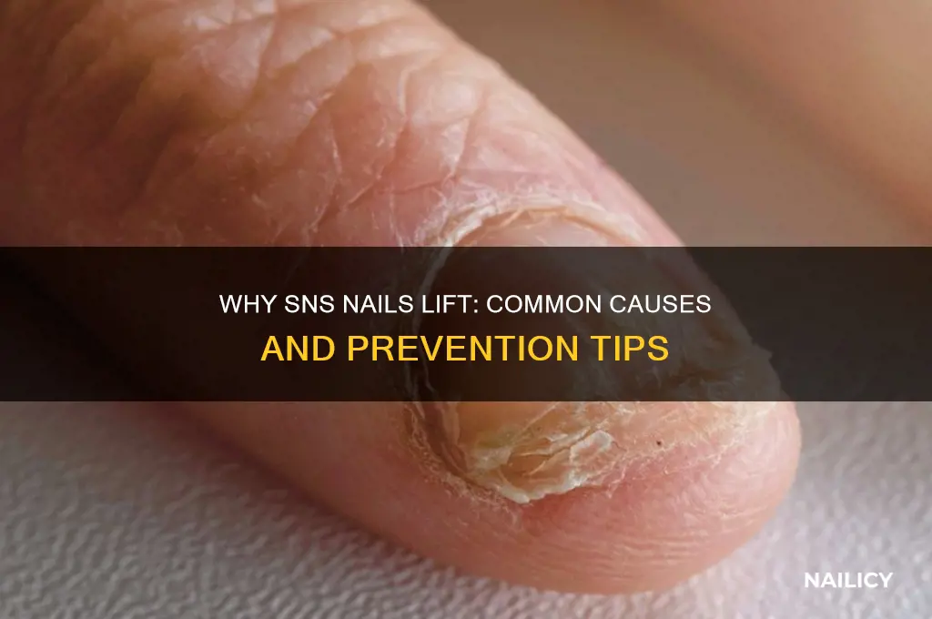 why do sns nails lift