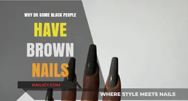 Understanding the Natural Brown Nail Color in Some Black Individuals