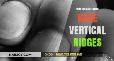 Understanding Vertical Nail Ridges: Causes and What They Mean