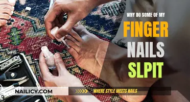 The Mystery of Split Fingernails: Causes and Cures