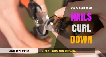Why Some Nails Curl Down: Causes and Solutions Explained