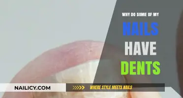 Why Do Some Nails Have Dents? Causes and Solutions Explained