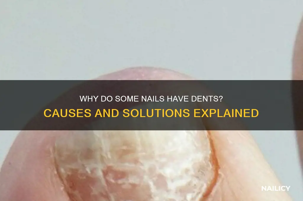 why do some of my nails have dents