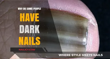 Understanding Dark Nails: Causes, Concerns, and Common Triggers Explained