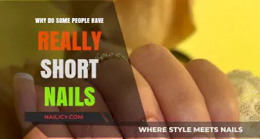 Why Some People Naturally Have Short Nails: Exploring the Reasons