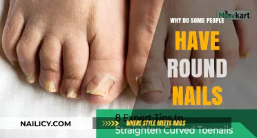 Round Nails Explained: Uncovering the Genetics and Health Factors Behind the Shape