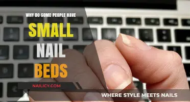 Understanding Small Nail Beds: Causes and Genetic Factors Explained